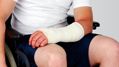 Read more about the article <h1>Top-Rated Bone Fracture Lawyer for Injury Lawsuits</h1>